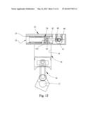 Sliding Valve Aspiration diagram and image