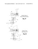 Sliding Valve Aspiration diagram and image