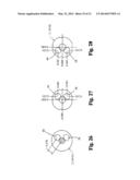 Sliding Valve Aspiration diagram and image