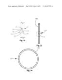 Sliding Valve Aspiration diagram and image