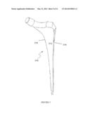 POROUS SURFACE LAYERS WITH INCREASED SURFACE ROUGHNESS AND IMPLANTS     INCORPORATING THE SAME diagram and image