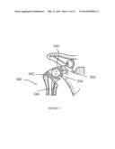 POROUS SURFACE LAYERS WITH INCREASED SURFACE ROUGHNESS AND IMPLANTS     INCORPORATING THE SAME diagram and image