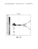 ULTRA-WIDEBAND ANTENNA HAVING FREQUENCY BAND NOTCH FUNCTION diagram and image