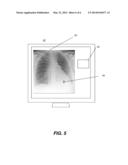 METHOD FOR X-RAY DOSE TRACKING diagram and image