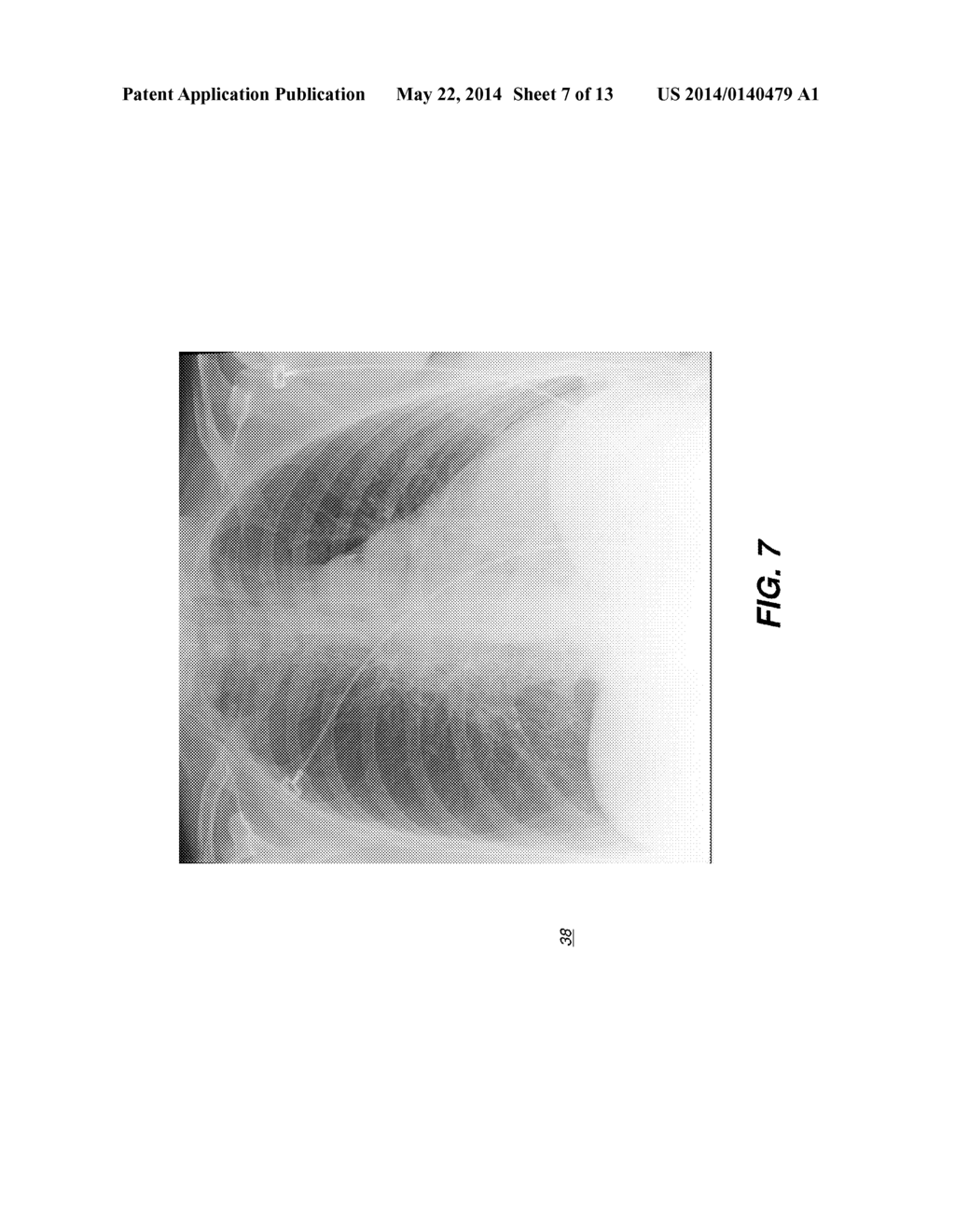 HYBRID DUAL ENERGY IMAGING AND BONE SUPPRESSION PROCESSING - diagram, schematic, and image 08