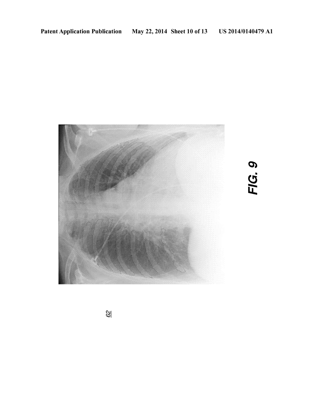 HYBRID DUAL ENERGY IMAGING AND BONE SUPPRESSION PROCESSING - diagram, schematic, and image 11