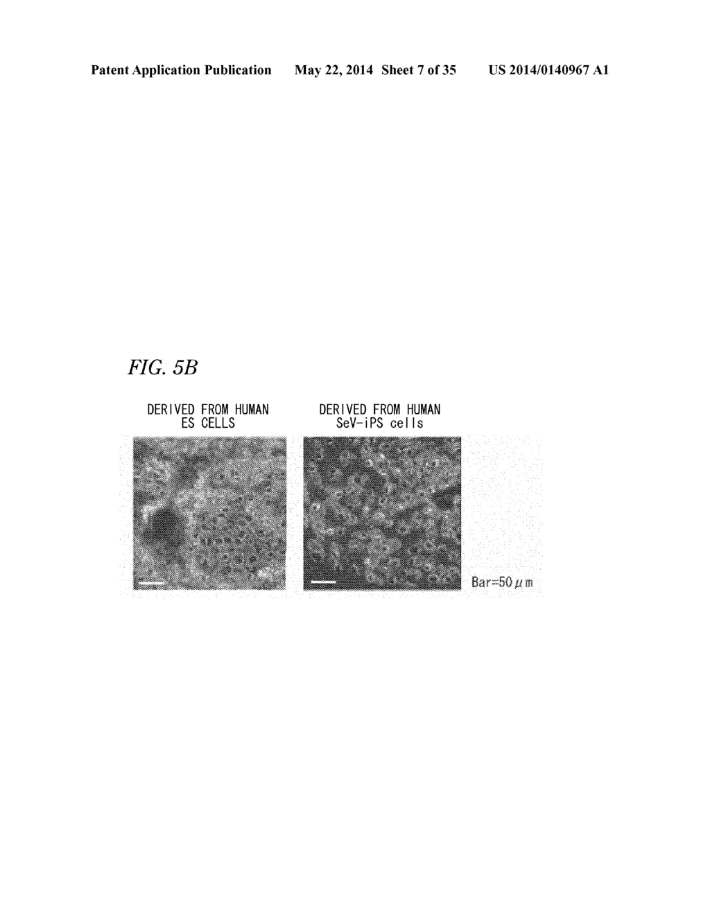 PLURIPOTENT STEM CELL-DERIVED BROWN ADIPOCYTES, PLURIPOTENT STEM     CELL-DERIVED CELL AGGREGATE, METHOD FOR PRODUCING SAME, AND CELL THERAPY     AND MEDICAL THERAPY THEREFOR - diagram, schematic, and image 08