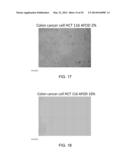 Manufacturing and Purification Processes of Complex Protein found in     Fraction IV to make a separated Apo, Transferrin, and Alpha 1 Anti     strepsin (A1AT) or A combined Transferrin/Apo/Human Albumin/A1AT and all     new found proteins diagram and image