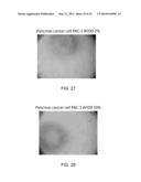 Manufacturing and Purification Processes of Complex Protein found in     Fraction IV to make a separated Apo, Transferrin, and Alpha 1 Anti     strepsin (A1AT) or A combined Transferrin/Apo/Human Albumin/A1AT and all     new found proteins diagram and image