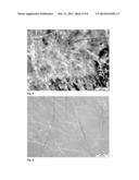 BIORESORBABLE WOUND DRESSING diagram and image