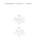 LASER ASSISTED PERIODONTIUM AND OSSEUS REGENERATION PROTOCOL diagram and image