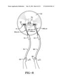 EXERCISE DEVICE USING UNDULATION MEMBERS diagram and image