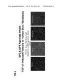 SKIN WOUND HEALING AND SCAR REDUCTION WITH PROSTAGLANDIN EP4 AGONIST     COMBINATIONS diagram and image