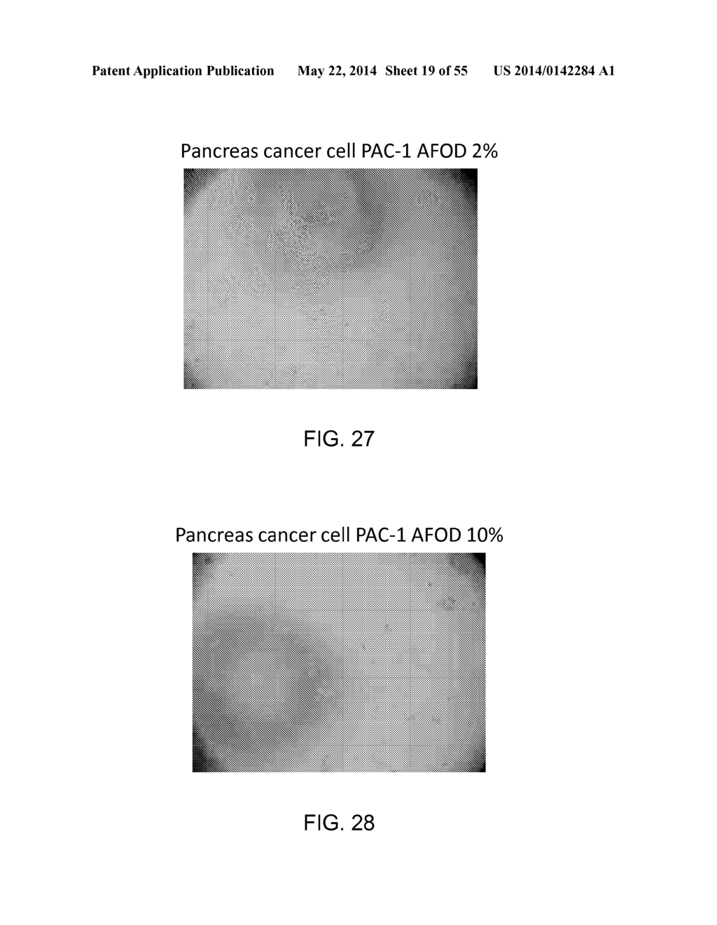 Manufacturing and Purification Processes of Complex Protein found in     Fraction IV to make a separated Apo, Transferrin, and Alpha 1 Anti     strepsin (A1AT) or A combined Transferrin/Apo/Human Albumin/A1AT and all     new found proteins - diagram, schematic, and image 20