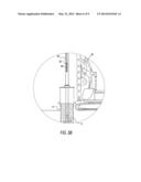 Method and apparatus for identification, stabilization and safe removal of     radioactive waste and non hazardous waste contained in buried objects diagram and image