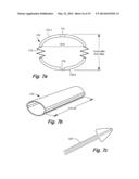 FLEXIBLE SURGICAL SHEATH AND MULTI-PART INSERTION CANNULA diagram and image