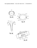 FLEXIBLE SURGICAL SHEATH AND MULTI-PART INSERTION CANNULA diagram and image