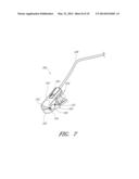 REPROCESSING OF A PHYSIOLOGICAL SENSOR diagram and image