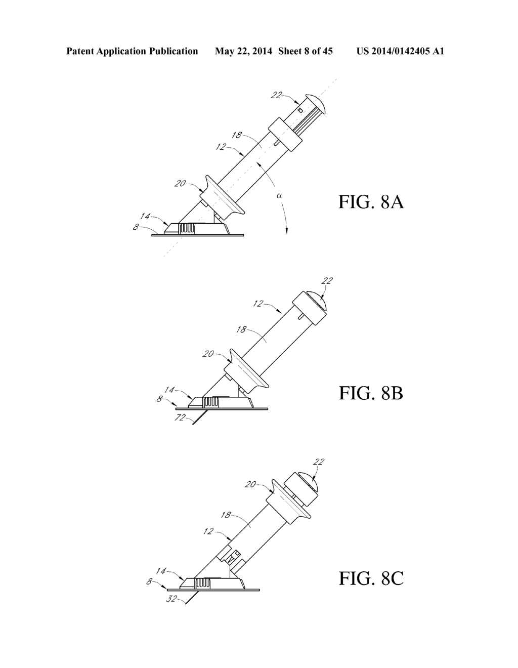 TRANSCUTANEOUS ANALYTE SENSOR - diagram, schematic, and image 09