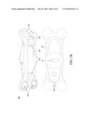 Portable Electrocardiography Device diagram and image