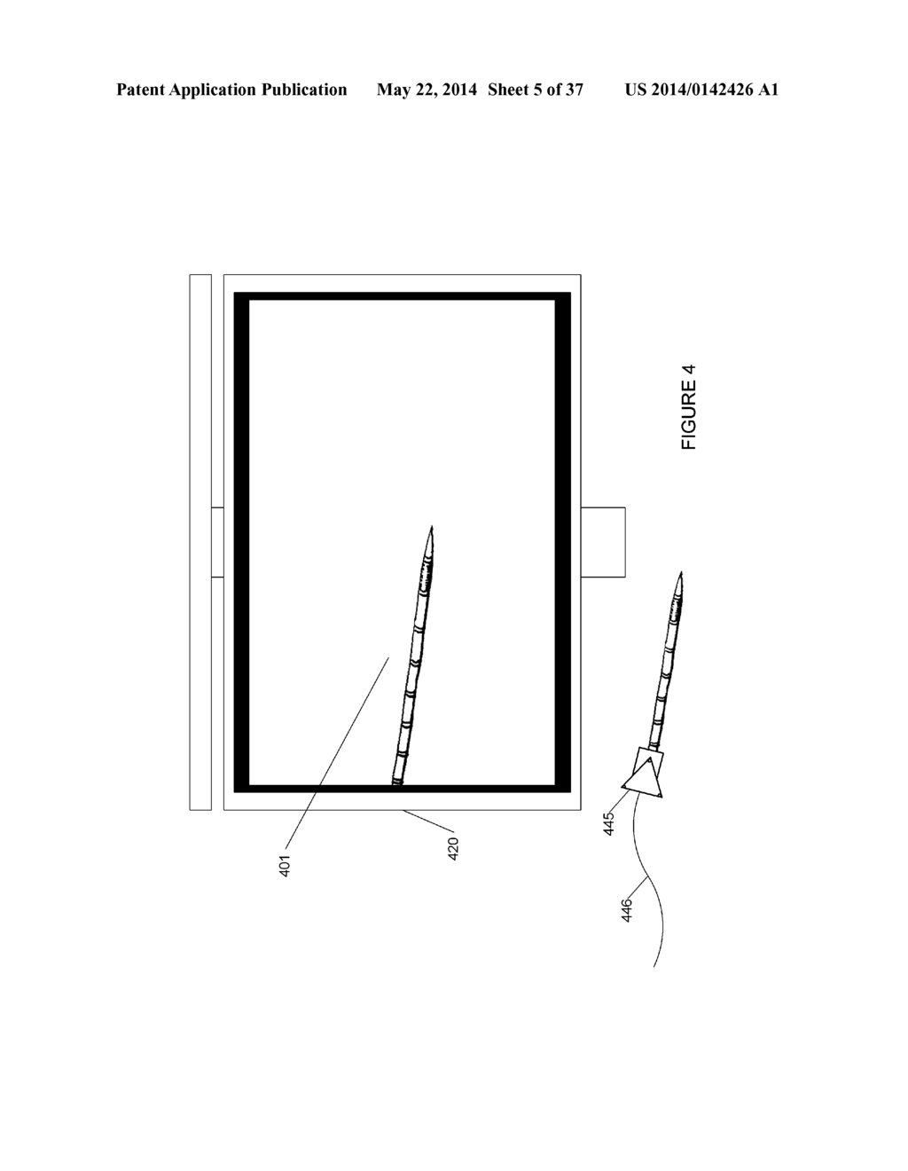 SYSTEMS, METHODS, APPARATUSES, AND COMPUTER-READABLE MEDIA FOR IMAGE     MANAGEMENT IN IMAGE-GUIDED MEDICAL PROCEDURES - diagram, schematic, and image 06