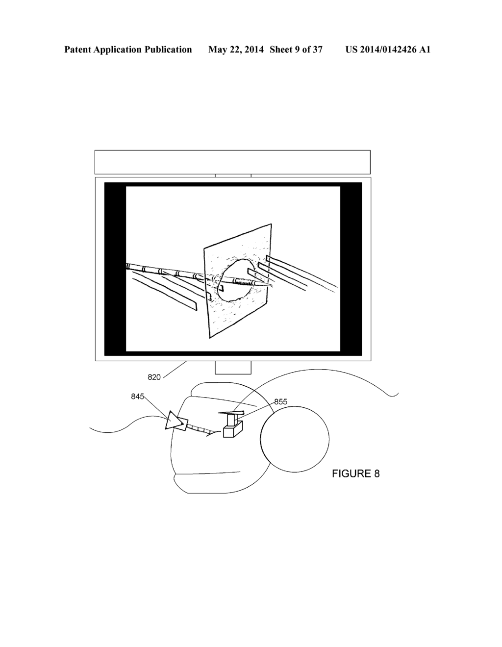 SYSTEMS, METHODS, APPARATUSES, AND COMPUTER-READABLE MEDIA FOR IMAGE     MANAGEMENT IN IMAGE-GUIDED MEDICAL PROCEDURES - diagram, schematic, and image 10