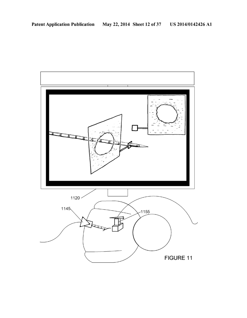 SYSTEMS, METHODS, APPARATUSES, AND COMPUTER-READABLE MEDIA FOR IMAGE     MANAGEMENT IN IMAGE-GUIDED MEDICAL PROCEDURES - diagram, schematic, and image 13