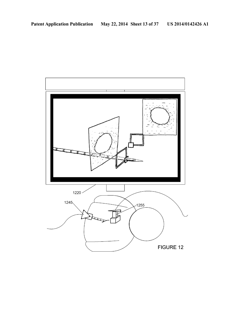 SYSTEMS, METHODS, APPARATUSES, AND COMPUTER-READABLE MEDIA FOR IMAGE     MANAGEMENT IN IMAGE-GUIDED MEDICAL PROCEDURES - diagram, schematic, and image 14