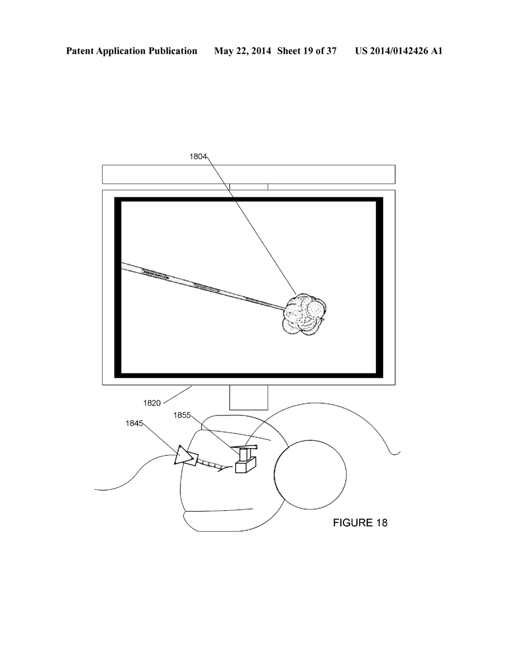 SYSTEMS, METHODS, APPARATUSES, AND COMPUTER-READABLE MEDIA FOR IMAGE     MANAGEMENT IN IMAGE-GUIDED MEDICAL PROCEDURES - diagram, schematic, and image 20