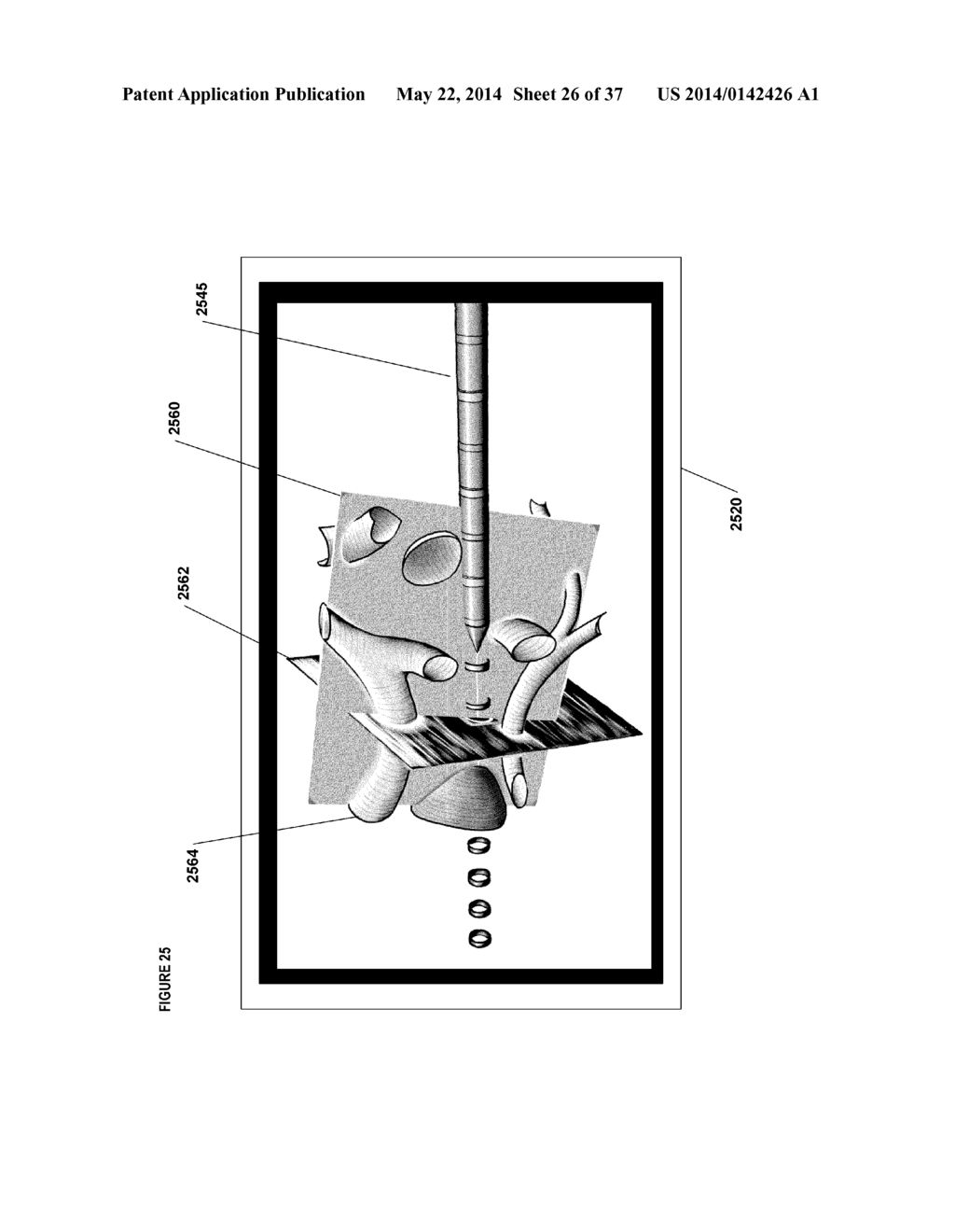 SYSTEMS, METHODS, APPARATUSES, AND COMPUTER-READABLE MEDIA FOR IMAGE     MANAGEMENT IN IMAGE-GUIDED MEDICAL PROCEDURES - diagram, schematic, and image 27