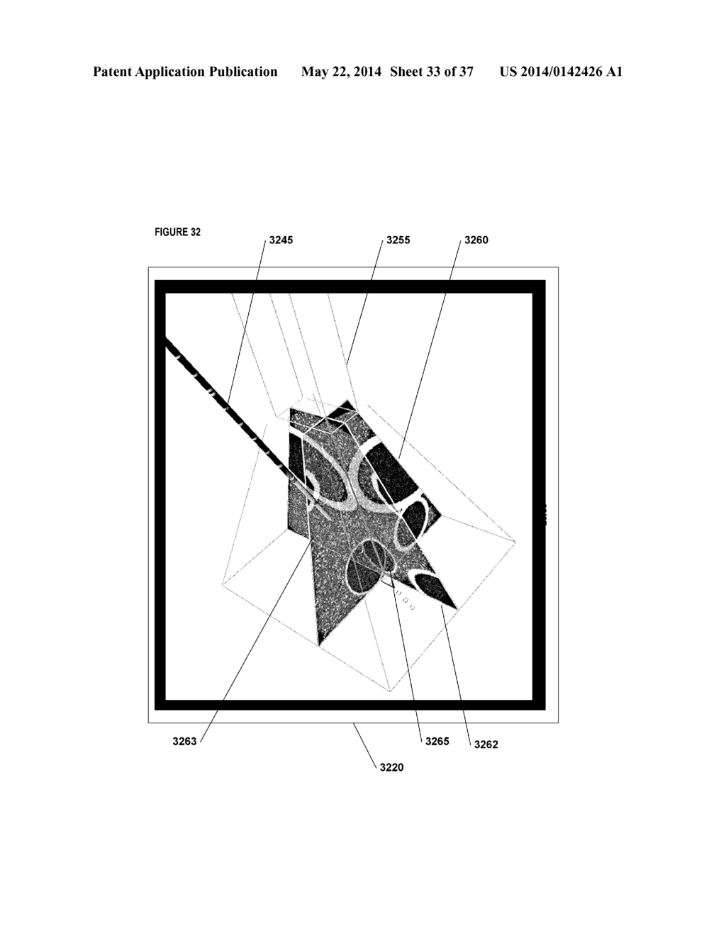 SYSTEMS, METHODS, APPARATUSES, AND COMPUTER-READABLE MEDIA FOR IMAGE     MANAGEMENT IN IMAGE-GUIDED MEDICAL PROCEDURES - diagram, schematic, and image 34