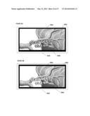 SYSTEMS, METHODS, APPARATUSES, AND COMPUTER-READABLE MEDIA FOR IMAGE     MANAGEMENT IN IMAGE-GUIDED MEDICAL PROCEDURES diagram and image