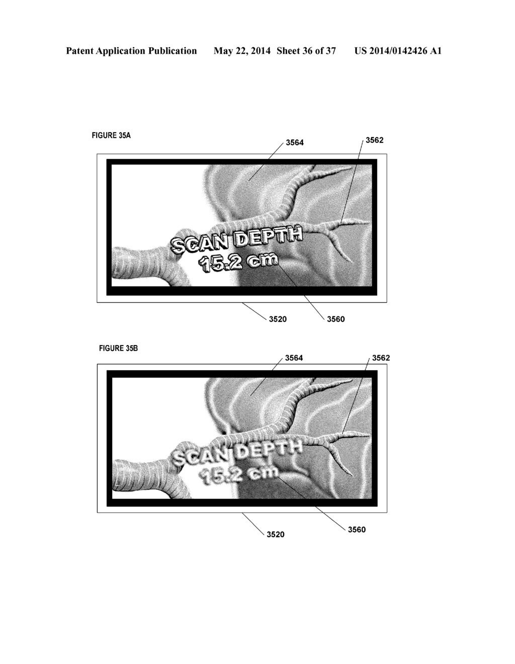 SYSTEMS, METHODS, APPARATUSES, AND COMPUTER-READABLE MEDIA FOR IMAGE     MANAGEMENT IN IMAGE-GUIDED MEDICAL PROCEDURES - diagram, schematic, and image 37