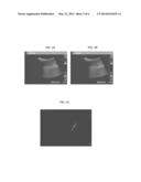 ULTRASOUND GUIDED ROBOT FOR FLEXIBLE NEEDLE STEERING diagram and image