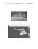 ULTRASOUND GUIDED ROBOT FOR FLEXIBLE NEEDLE STEERING diagram and image