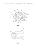 Skin Treatment Device Equipped with a Guide Means diagram and image