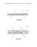 SELF-EXPANDING WOUND DRESSINGS diagram and image