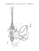 ELECTROSURGICAL TISSUE SEALER AND CUTTER diagram and image