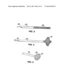 Temporary Vascular Scaffold and Scoring Device diagram and image