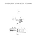 Temporary Vascular Scaffold and Scoring Device diagram and image