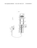 Temporary Vascular Scaffold and Scoring Device diagram and image