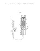 Temporary Vascular Scaffold and Scoring Device diagram and image