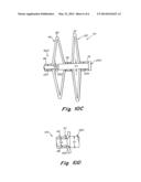 Catch Member for PFO Occluder diagram and image