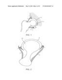 KNOTLESS SUTURE ANCHOR AND METHODS OF USE diagram and image