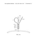 KNOTLESS SUTURE ANCHOR AND METHODS OF USE diagram and image