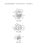 KNOTLESS SUTURE ANCHOR AND METHODS OF USE diagram and image