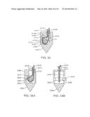 KNOTLESS SUTURE ANCHOR AND METHODS OF USE diagram and image