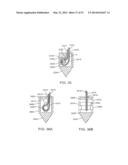 KNOTLESS SUTURE ANCHOR AND METHODS OF USE diagram and image