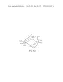 KNOTLESS SUTURE ANCHOR AND METHODS OF USE diagram and image