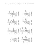 KNOTLESS SUTURE ANCHOR AND METHODS OF USE diagram and image